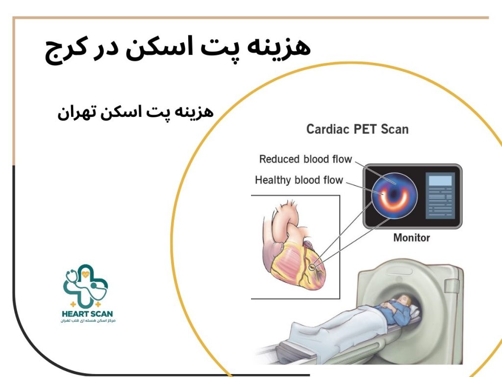 هزینه پت اسکن در کرج