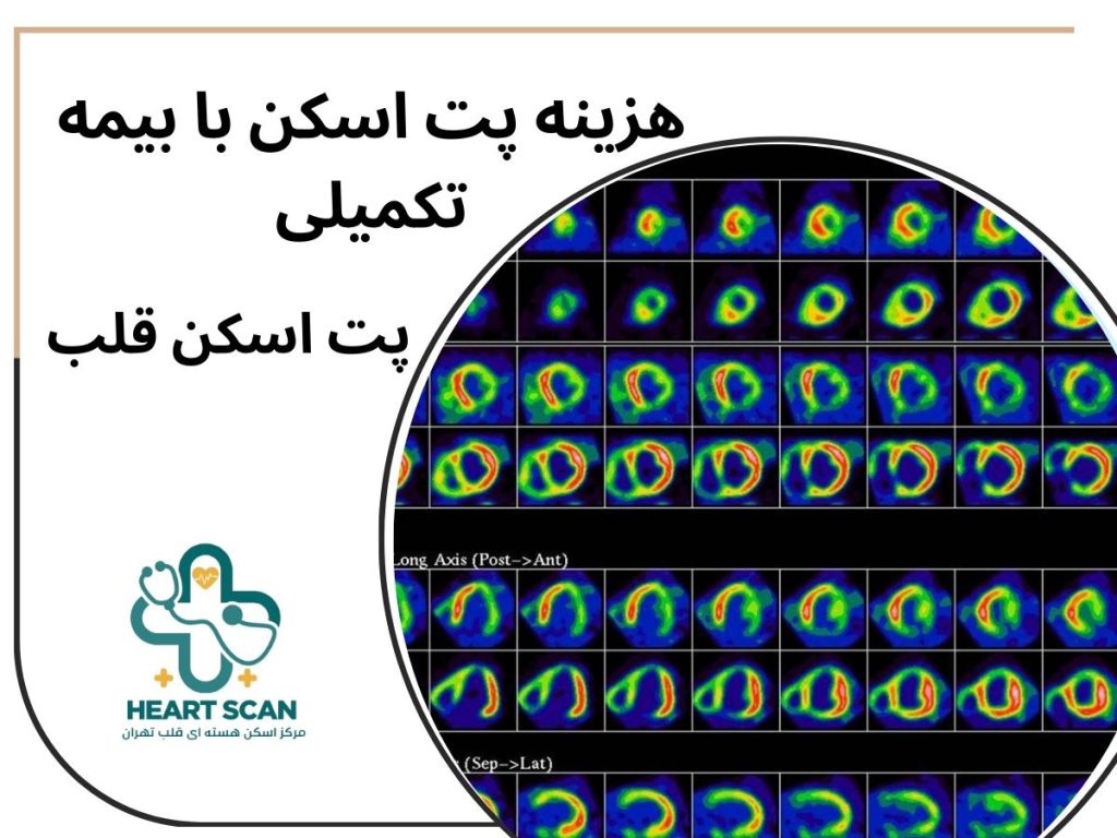 هزینه پت اسکن با بیمه تکمیلی