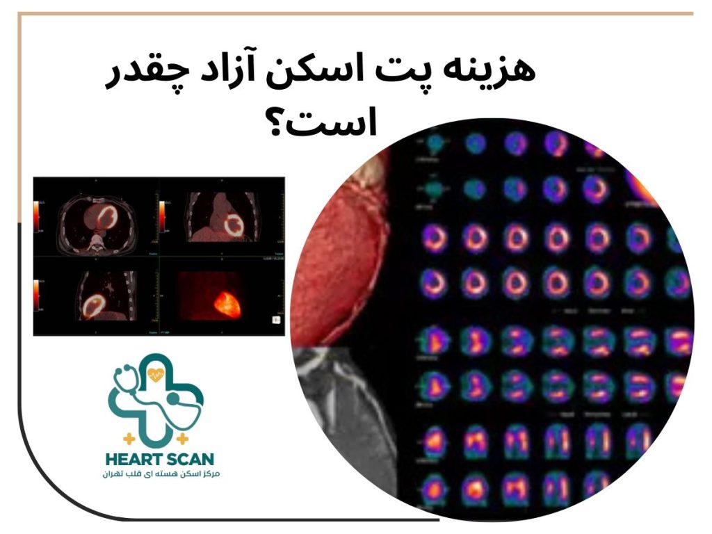 هزینه پت اسکن آزاد چقدر است؟ اسکن قلب