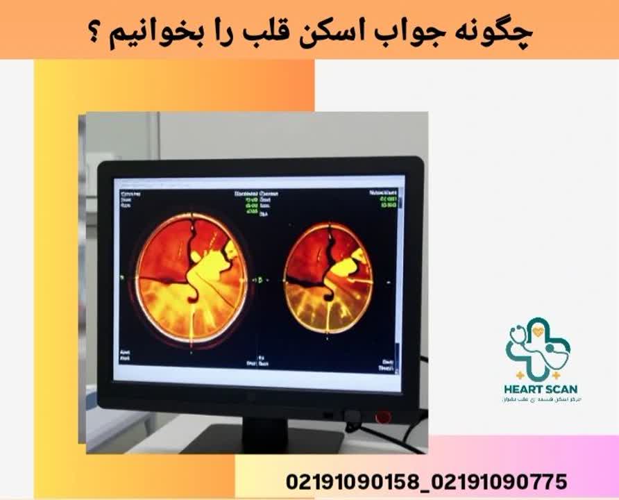 چگونه جواب اسکن قلب را بخوانیم