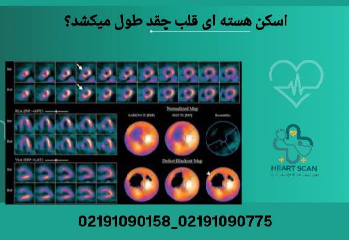اسکن قلب چقدر طول میکشد