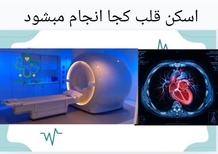 هزینه اسکن هستهای قلب | مقایسه مراکز دولتی و خصوصی اسکن هسته ای قلب کجا انجام میشود
