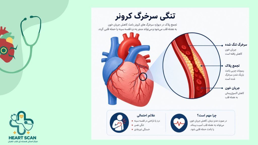 نمایش دلایل ایجاد تنگی عروق کرونر و عوامل خطر در زنان علائم گرفتگی رگ قلب در زنان